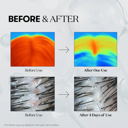 VerraNaturals PDRN Reedle Shot Hair Ampoule